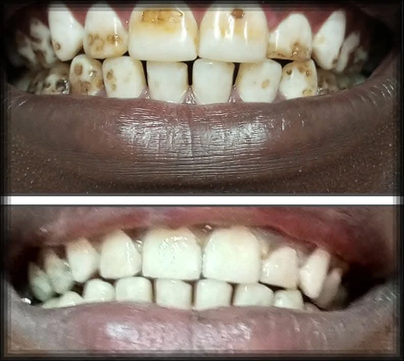 Meno Safi dental clinic 